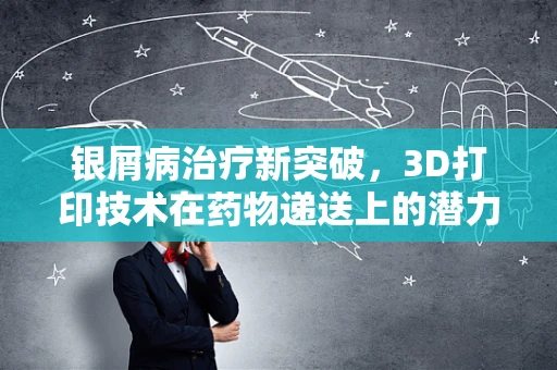 银屑病治疗新突破，3D打印技术在药物递送上的潜力