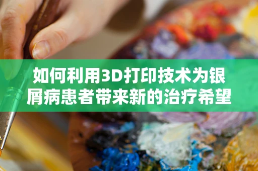 如何利用3D打印技术为银屑病患者带来新的治疗希望？