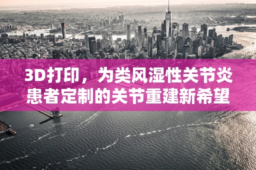 3D打印，为类风湿性关节炎患者定制的关节重建新希望？